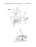 DUAL STAGE ULTRAFILTER DEVICES IN THE FORM OF PORTABLE FILTER DEVICES,     SHOWER DEVICES, AND HYDRATION diagram and image