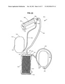 DUAL STAGE ULTRAFILTER DEVICES IN THE FORM OF PORTABLE FILTER DEVICES,     SHOWER DEVICES, AND HYDRATION diagram and image