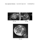 SCANNING LASER INFRARED MOLECULAR SPECTROMETER diagram and image