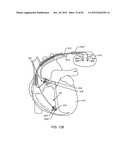 SHIELDED THREE-TERMINAL FLAT-THROUGH EMI/ENERGY DISSIPATING FILTER diagram and image