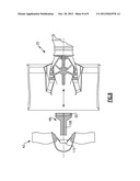 GAS TURBINE ENGINE FRONT CENTER BODY ARCHITECTURE diagram and image