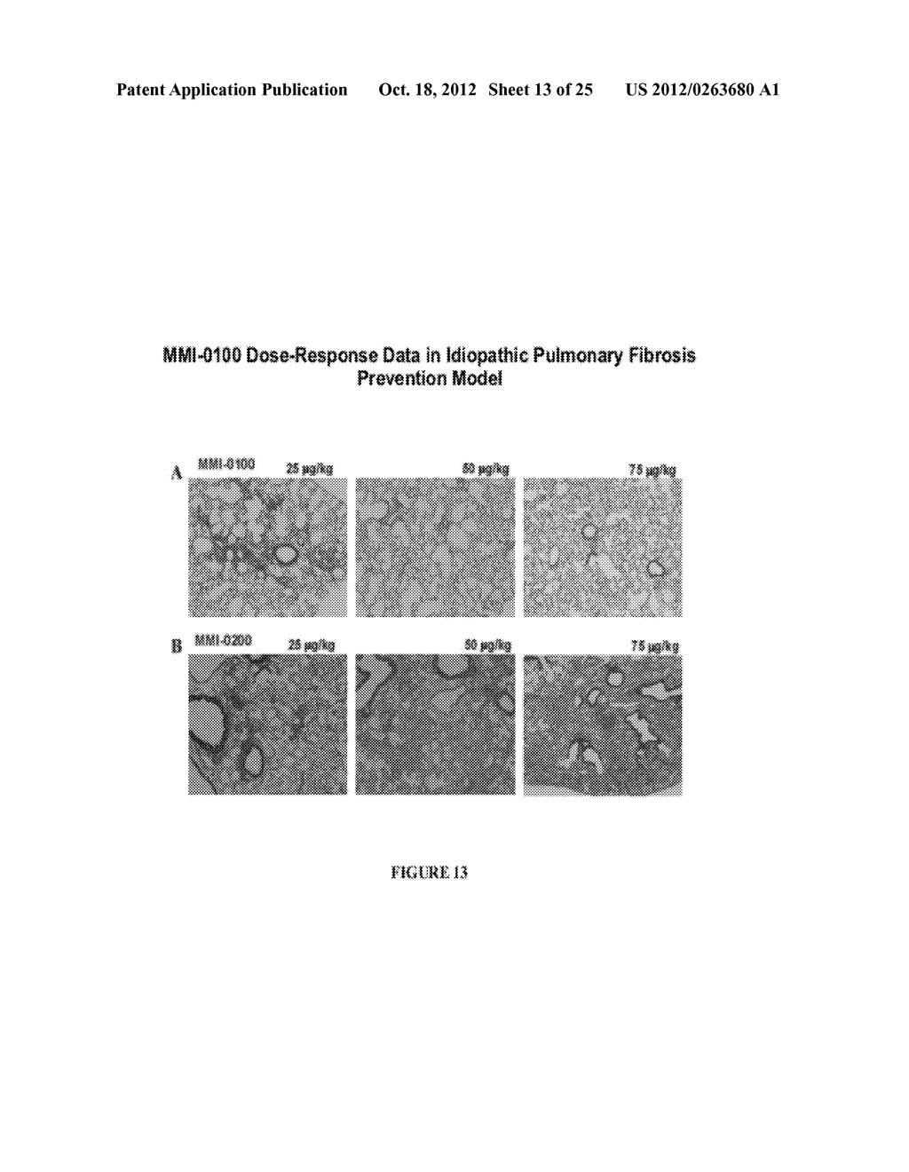 Compositions And Methods For Preventing Or Treating Diseases, Conditions,     Or Processes Characterized By Aberrant Fibroblast Proliferation And     Extracellular Matrix Deposition - diagram, schematic, and image 14