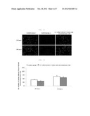 ANTI-TUMOR COMPOSITION COMPRISING HUMAN-DERIVED ADULT STEM CELLS diagram and image