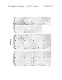 Use of Mesenchymal Stem Cells for Treating Genetic Disease and Disorders diagram and image