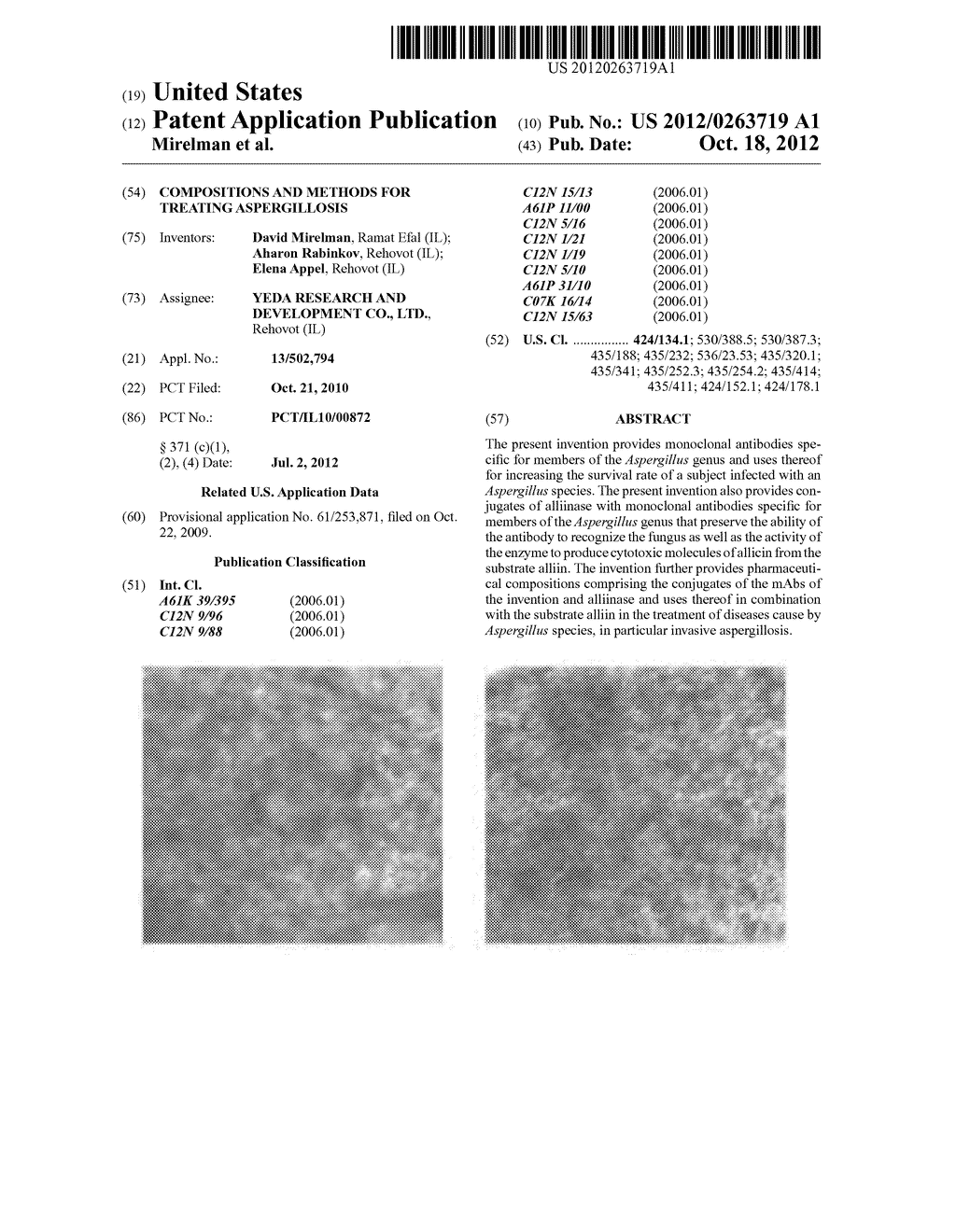 COMPOSITIONS AND METHODS FOR TREATING ASPERGILLOSIS - diagram, schematic, and image 01