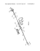 BPH LASER ABLATION SIMULATION diagram and image