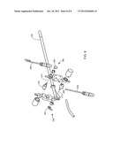 BPH LASER ABLATION SIMULATION diagram and image