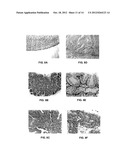 Extracellular Serine Protease diagram and image