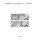 DETECTION OF B-CELL ACTIVATING FACTOR AS A BIOMARKER FOR ANTIBODY MEDIATED     REJECTION IN TRANSPLANT RECIPIENTS diagram and image