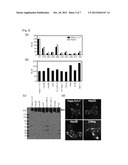 Diagnostic Marker for Hepatocellular Carcinoma Comprising Anti-FASN     Autoantibodies and a Diagnostic Composition for Hepatocellular Carcinoma     Comprising Antigens Thereof diagram and image