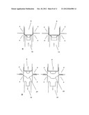 FORMING DEVICE FOR THE COLD-FORMING OF POCKETS FOR MEDICAL OR     PHARMACEUTICAL PRODUCTS IN A SHEET diagram and image