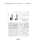 METHODS AND COMPOSITIONS FOR PREDICTING SURVIVAL IN SUBJECTS WITH CANCER diagram and image