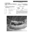 METHODS OF USING BASIC FIBROBLAST GROWTH FACTOR TO PREVENT ACUTE WOUND     FAILURE diagram and image