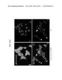 OXAZOLE AND THIAZOLE COMPOUNDS AS BETA-CATENIN MODULATORS AND USES THEREOF diagram and image