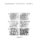 USE OF EQUOL FOR TREATING ANDROGEN MEDIATED DISEASES diagram and image