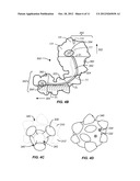 DEVICES, SYSTEMS, KITS AND METHODS FOR TREATMENT OF OBESITY diagram and image