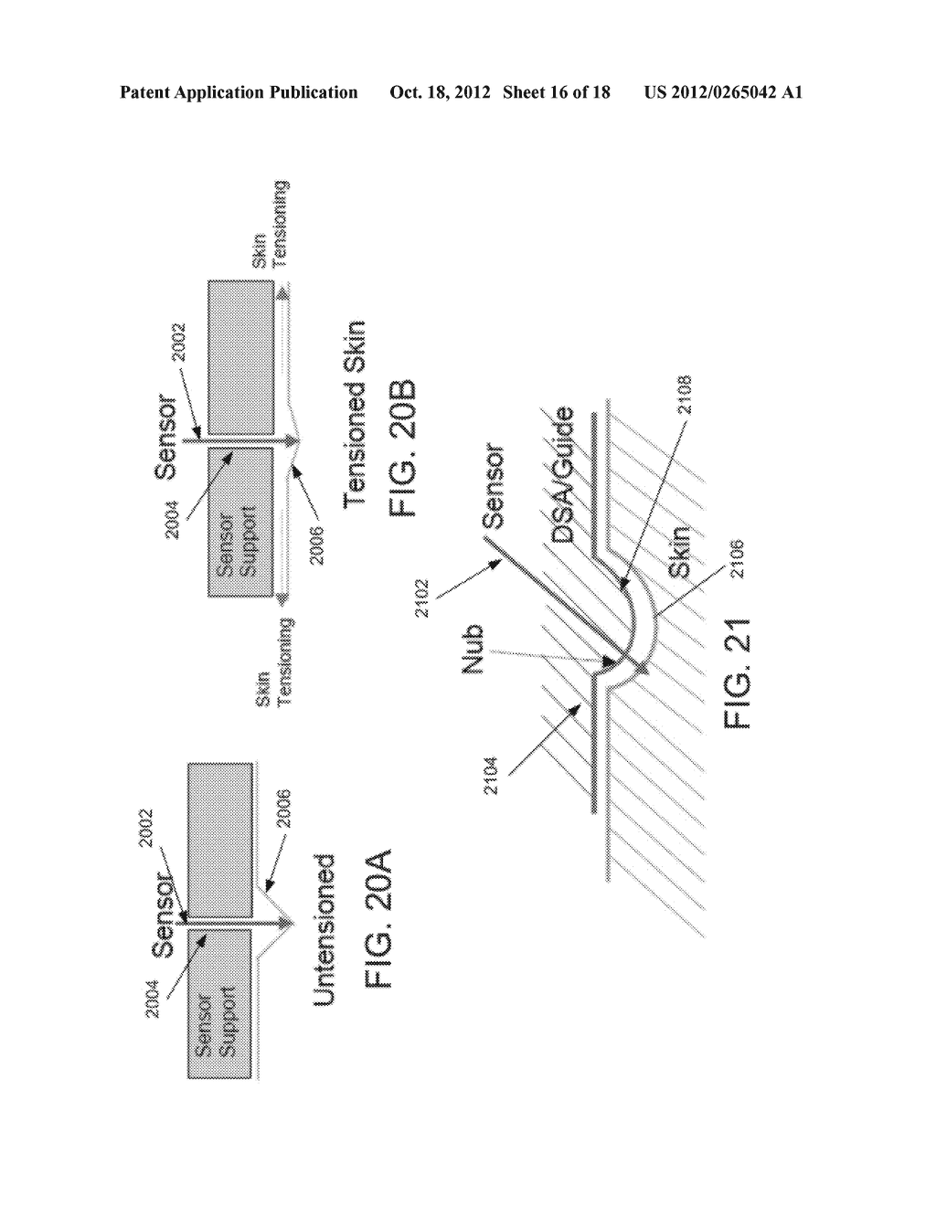 METHOD AND APPARATUS FOR INSERTION OF A SENSOR - diagram, schematic, and image 17