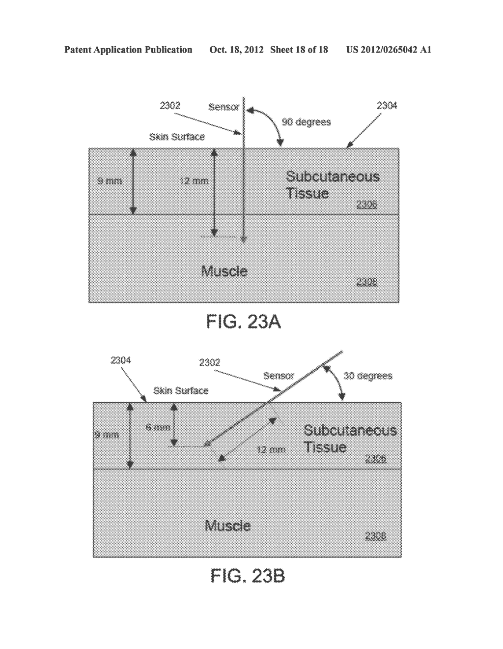 METHOD AND APPARATUS FOR INSERTION OF A SENSOR - diagram, schematic, and image 19