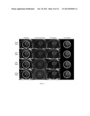 Omni-Tomographic Imaging for Interior Reconstruction using Simultaneous     Data Acquisition from Multiple Imaging Modalities diagram and image