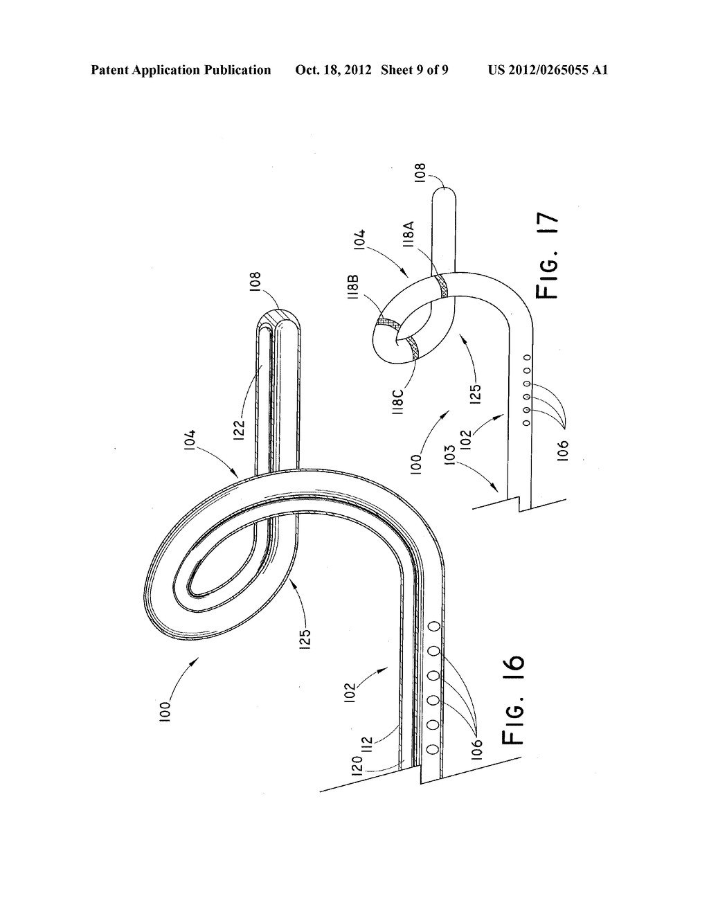 TUBULAR FEEDING DEVICE HAVING SHAPEABLE DISTAL END - diagram, schematic, and image 10