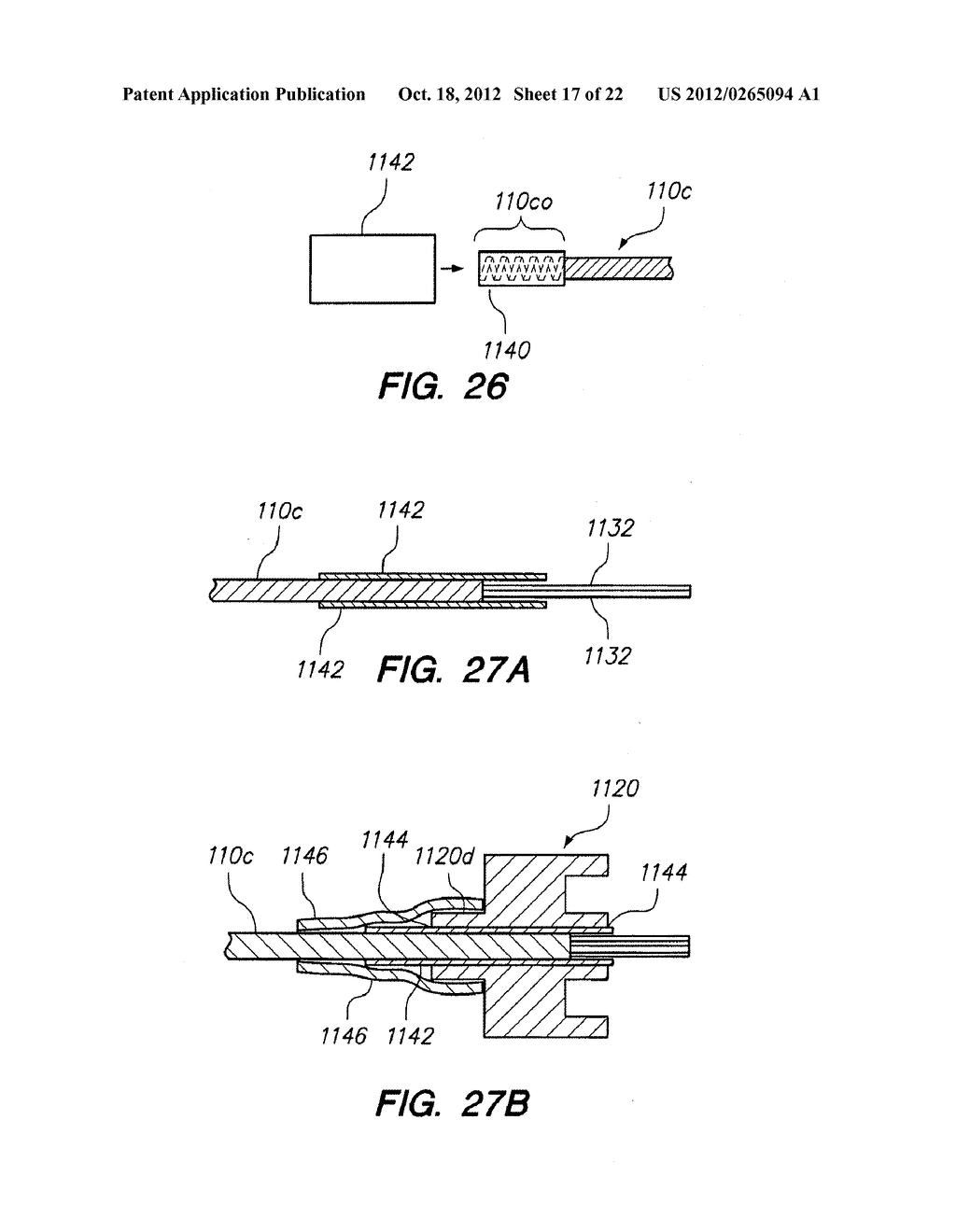 Endoscopic Methods and Devices for Transnasal Procedures - diagram, schematic, and image 18