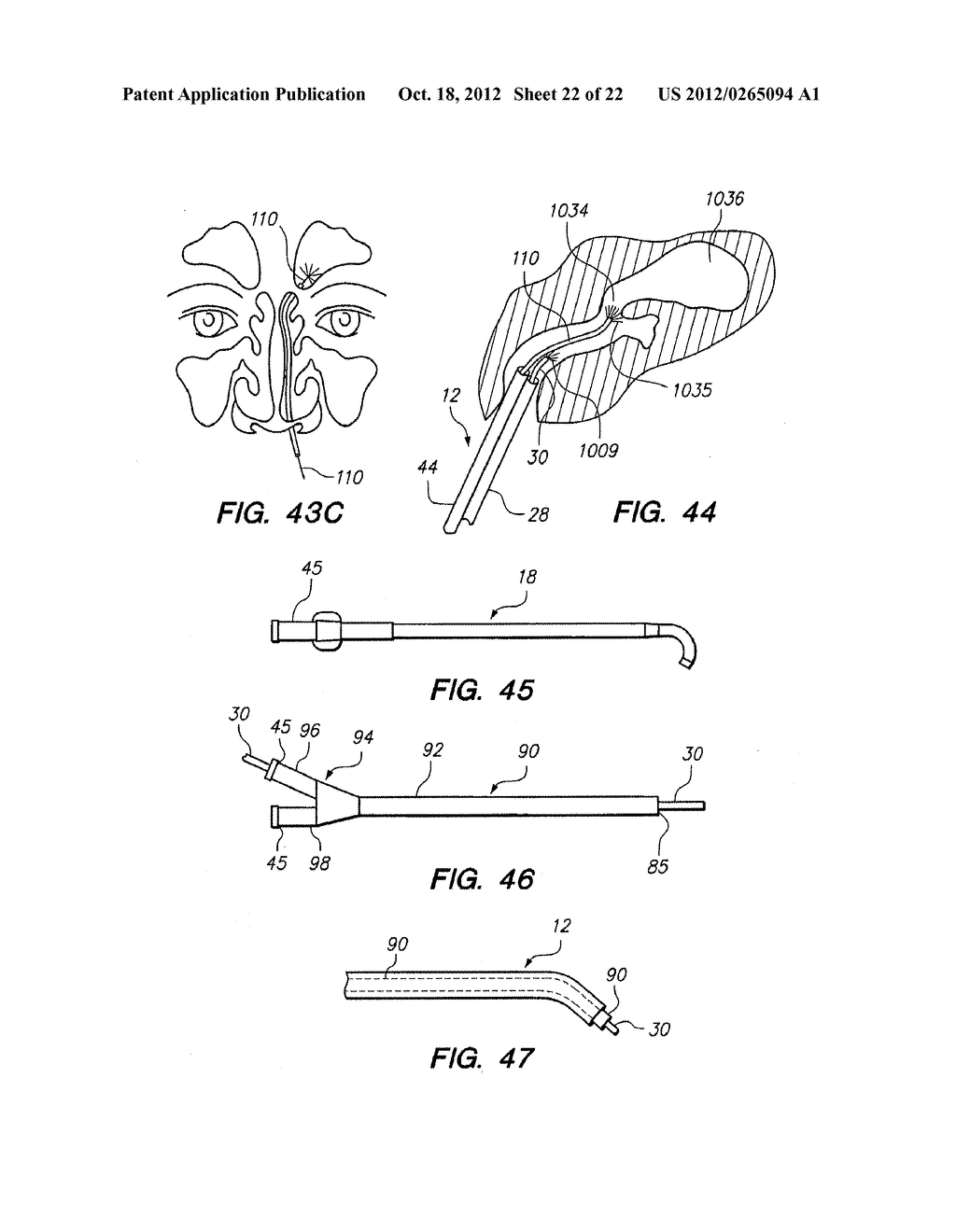 Endoscopic Methods and Devices for Transnasal Procedures - diagram, schematic, and image 23