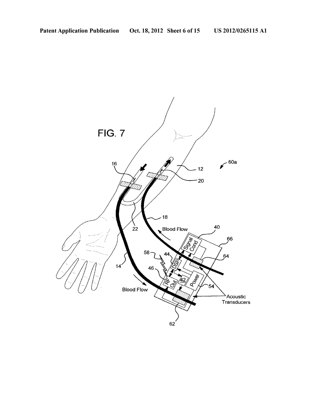 ACOUSTIC ACCESS DISCONNECTION SYSTEMS AND METHODS - diagram, schematic, and image 07