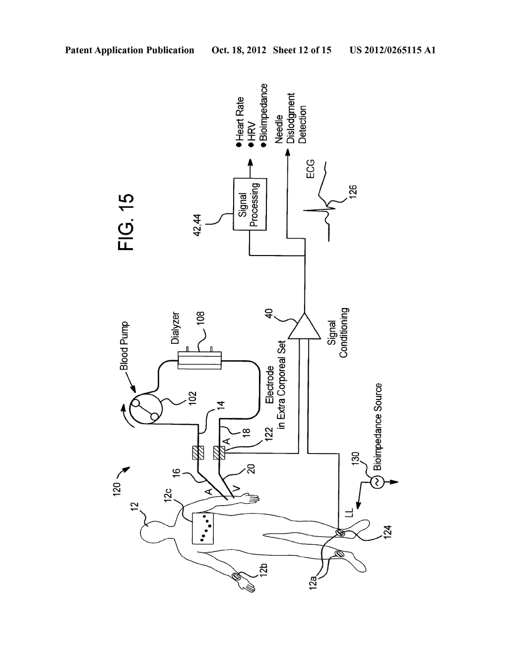 ACOUSTIC ACCESS DISCONNECTION SYSTEMS AND METHODS - diagram, schematic, and image 13