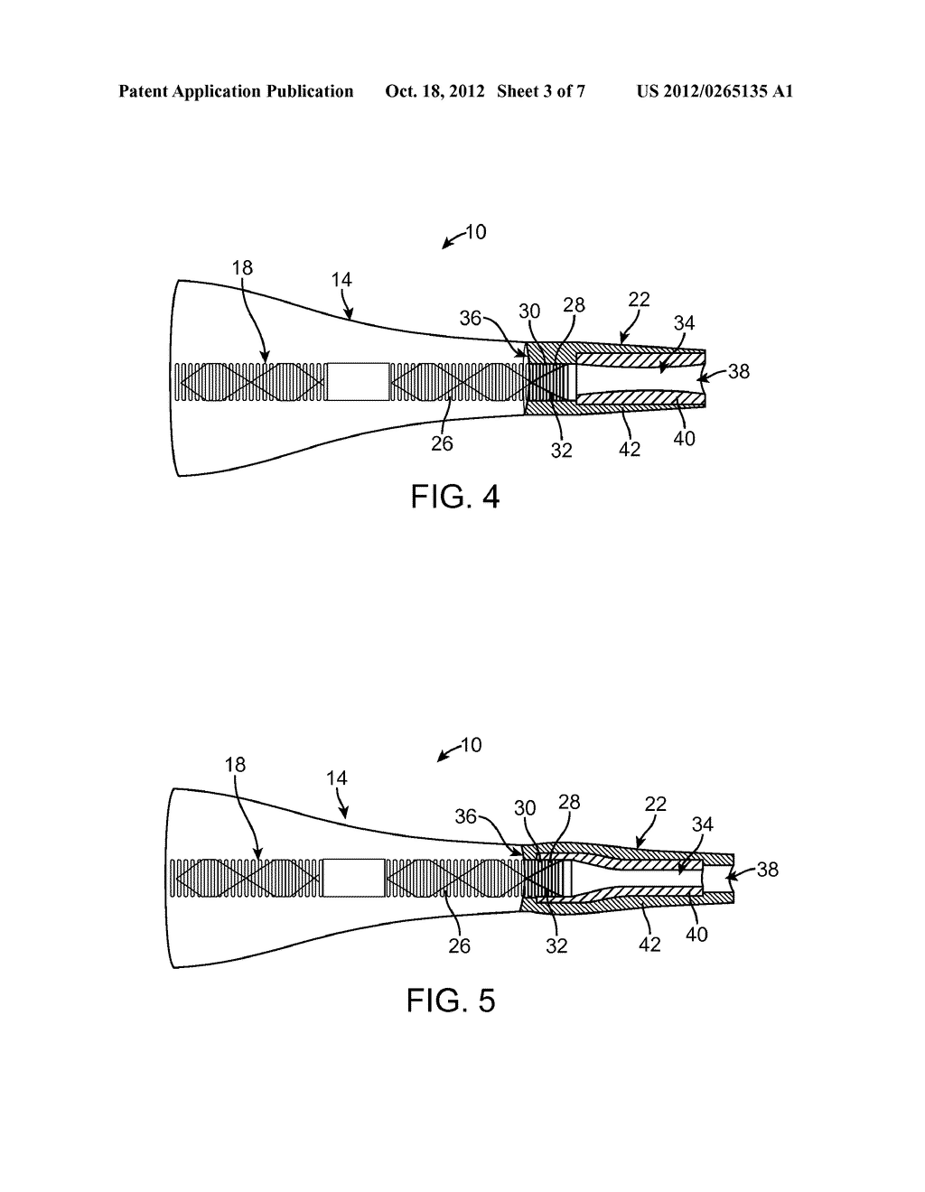 BALLOON CATHETER - diagram, schematic, and image 04