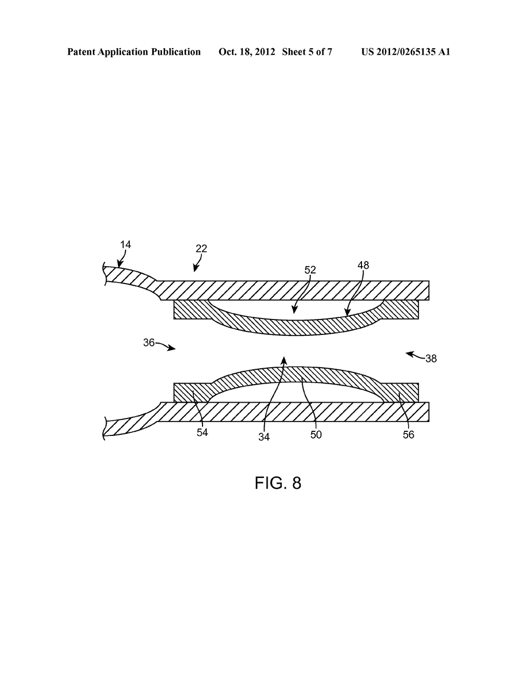 BALLOON CATHETER - diagram, schematic, and image 06