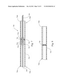 APPARATUS FOR ACCURATELY CONTROLLING NEEDLE EXTENSION diagram and image