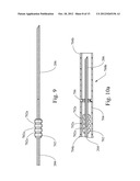 APPARATUS FOR ACCURATELY CONTROLLING NEEDLE EXTENSION diagram and image