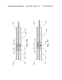 APPARATUS FOR ACCURATELY CONTROLLING NEEDLE EXTENSION diagram and image