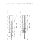 APPARATUS FOR ACCURATELY CONTROLLING NEEDLE EXTENSION diagram and image