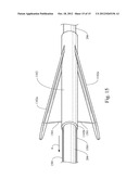 APPARATUS FOR ACCURATELY CONTROLLING NEEDLE EXTENSION diagram and image