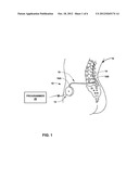 IMPLANTABLE FLUID DELIVERY DEVICE INCLUDING GAS CHAMBER PRESSURE SENSOR diagram and image