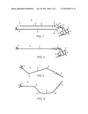 MALLEABLE INSTRUMENT FOR LAPAROSCOPIC PROCEDURES diagram and image