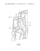 ENDOVENOUS LASER TREATMENT GENERATING REDUCED BLOOD COAGULATION diagram and image