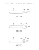 ENDOVENOUS LASER TREATMENT GENERATING REDUCED BLOOD COAGULATION diagram and image