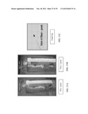 ENDOVENOUS LASER TREATMENT GENERATING REDUCED BLOOD COAGULATION diagram and image