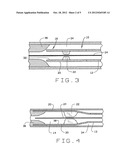 Expandable Laser Catheter diagram and image