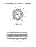 Expandable Laser Catheter diagram and image