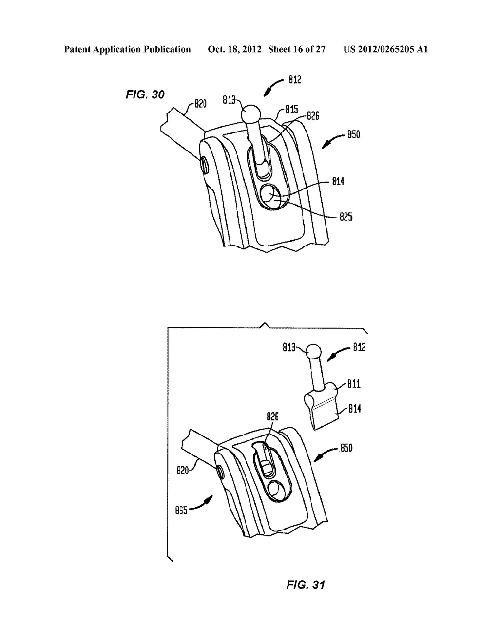 FLEXIBLE ACL INSTRUMENTATION, KIT AND METHOD - diagram, schematic, and image 17