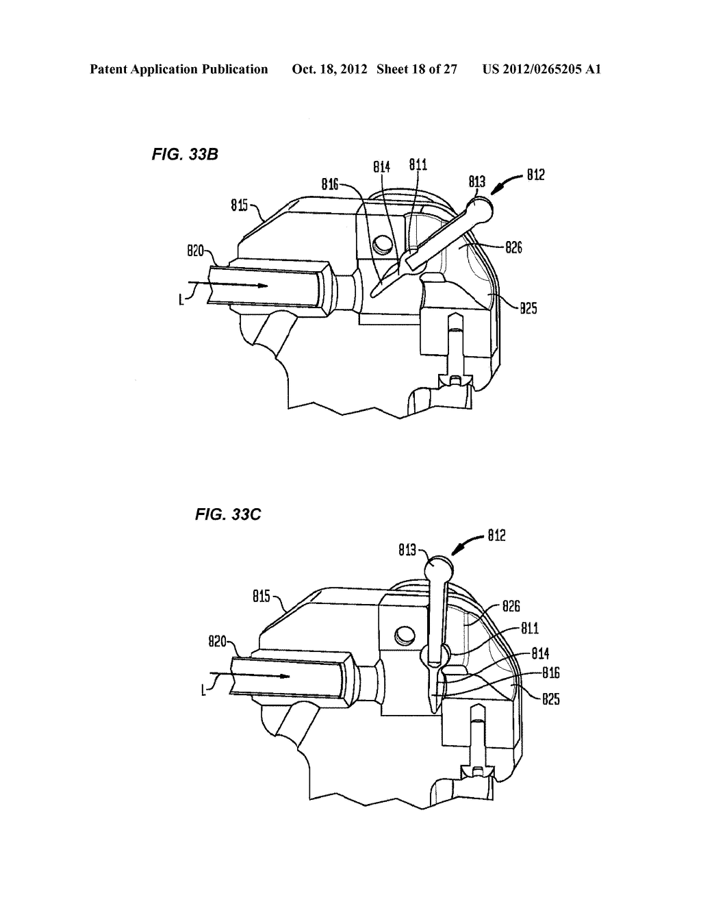 FLEXIBLE ACL INSTRUMENTATION, KIT AND METHOD - diagram, schematic, and image 19