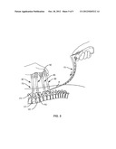 APPARATUS AND METHOD FOR SIZING A CONNECTING ELEMENT FOR POSITIONING ALONG     A BONE STRUCTURE diagram and image