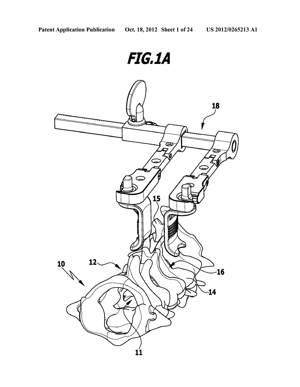 SURGICAL DISTRACTION INSTRUMENT FOR LAMINOPLASTY - diagram, schematic, and image 02