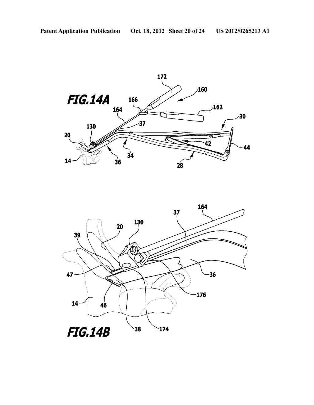 SURGICAL DISTRACTION INSTRUMENT FOR LAMINOPLASTY - diagram, schematic, and image 21