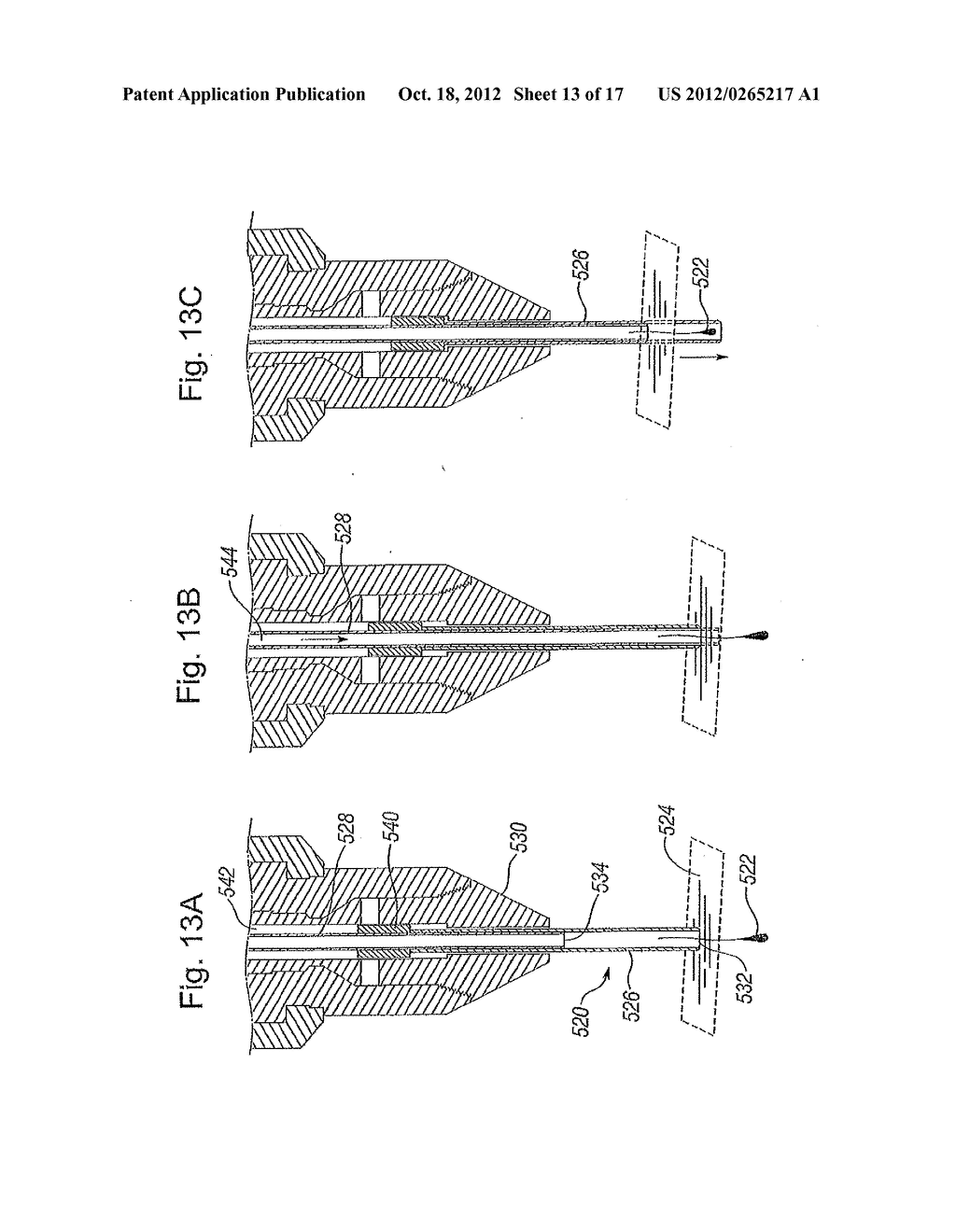 BIOLOGICAL UNIT REMOVAL TOOLS WITH MOVABLE RETENTION MEMBER - diagram, schematic, and image 14