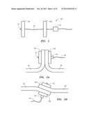 DEVICES AND METHODS FOR LAPAROSCOPIC HERNIA REPAIR diagram and image