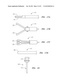 DEVICES AND METHODS FOR LAPAROSCOPIC HERNIA REPAIR diagram and image